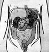 abdomen